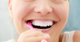 Все, что нужно знать о стоматологической подготовки зубов перед свадьбой