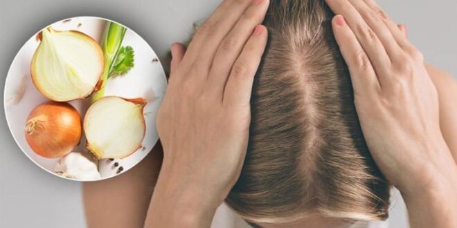 Действительно ли нанесение сока сырого лука на кожу головы уменьшает выпадение волос?